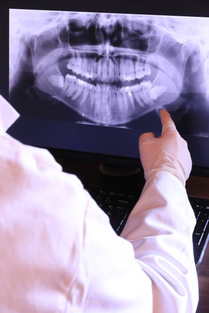 Best Emergency Dental Care for Broken or Chipped Teeth in Itasca, IL